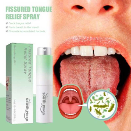 Fissured Tongue Relief Spray (১ পিস কিনলে ১ পিস ফ্রি )